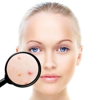 Treatments for common skin conditions Winchester