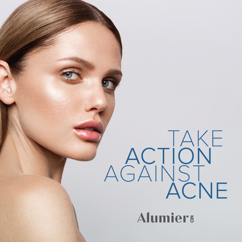 Acne Treatment Options Acne Treatment Options