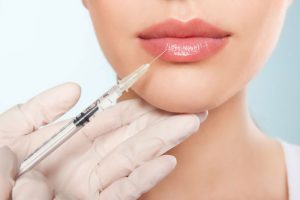 Lip Fillers at Sparx Aesthetics Clinic Winchester