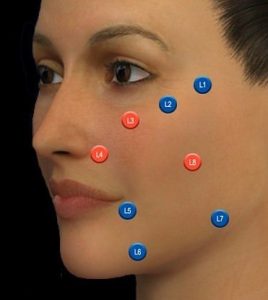 MD-Codes Dermal Fillers at Sparx Beauty and Aesthetics Clinic Winchester