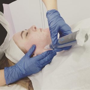 SKINPEN MICRONEEDLING ANTI AGEING FACE TREATMENTS IN WINCHESTER