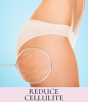 Cellulite Reduction Winchester Beauty Salon Cellulite Reduction Winchester Beauty Salon