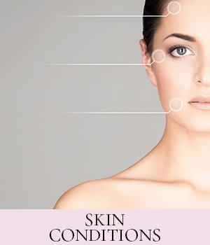 Skin Care Experts Winchester Beauty Salon