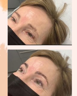 Brow Lamination & Lash Lift Deal Brow Lamination & Lash Lift Deal