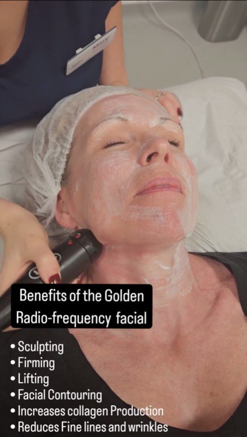Benefits of Golden RF Facials at Winchester Skin Clinic
