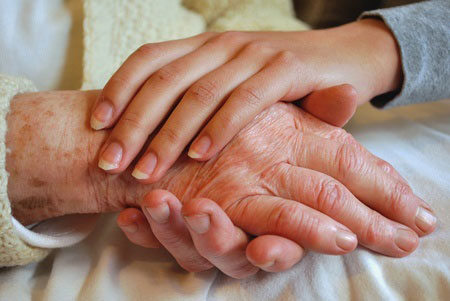 age-spot-removal, winchester beauty salon laser treatments