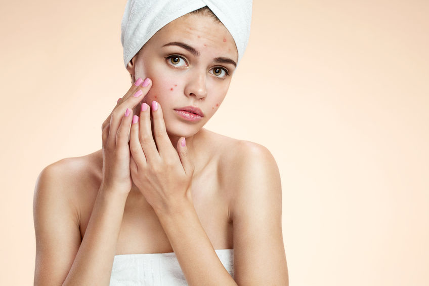 Skin Care for Acne Winchester Salon