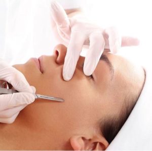 DERMAPLANING TREATMENT Winchester