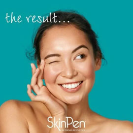 SKINPEN MICRONEEDLING Winchester Skin Clinic SKINPEN MICRONEEDLING Winchester Skin Clinic