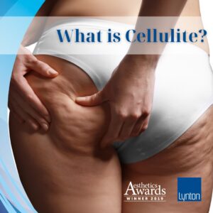 Cellulite removal Winchester