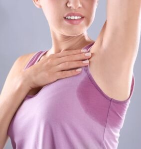 hyperhydrosis treatments Winchester