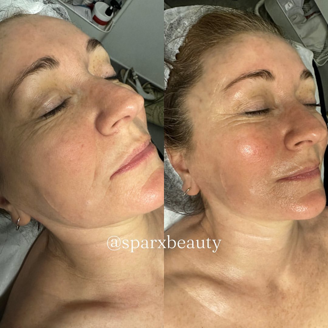 Dibi Milano anti aging facial Winchester skin clinic Dibi Milano anti aging facial Winchester skin clinic