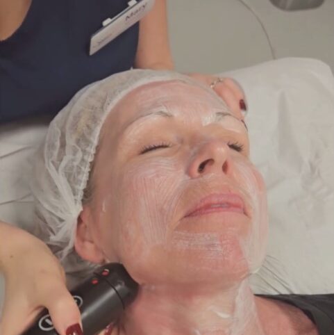 Benefits of Golden RF Facials at Winchester Skin Clinic Benefits of Golden RF Facials at Winchester Skin Clinic