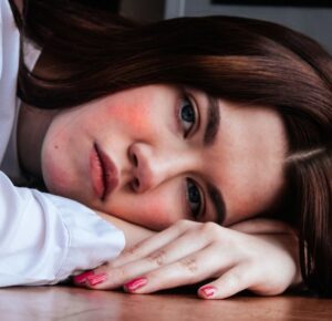 Treatments for rosacea Winchester