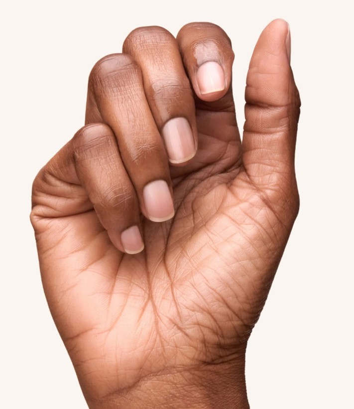 Nail Treatments Winchester