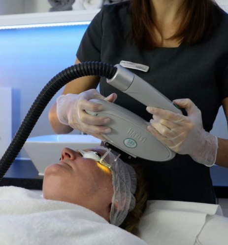 Laser photofacials in Winchester at Sparx Beauty Salon