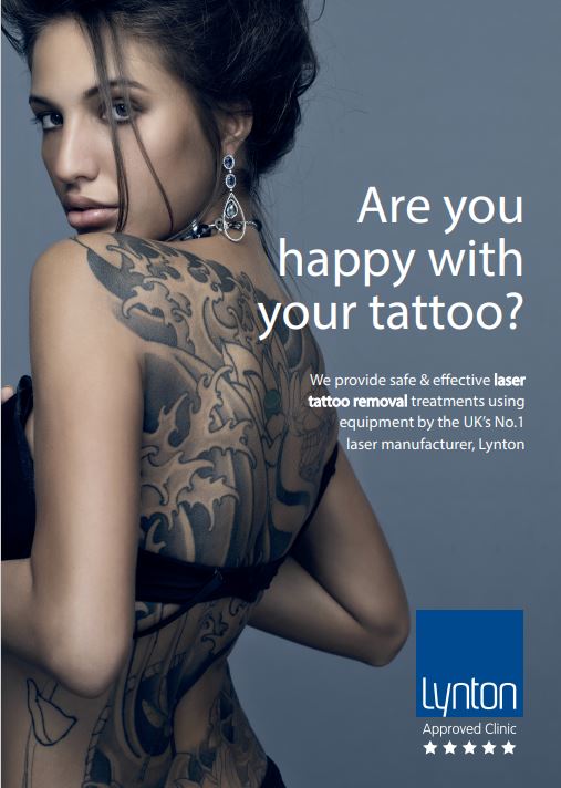 laser tattoo removal in Winchester laser tattoo removal in Winchester