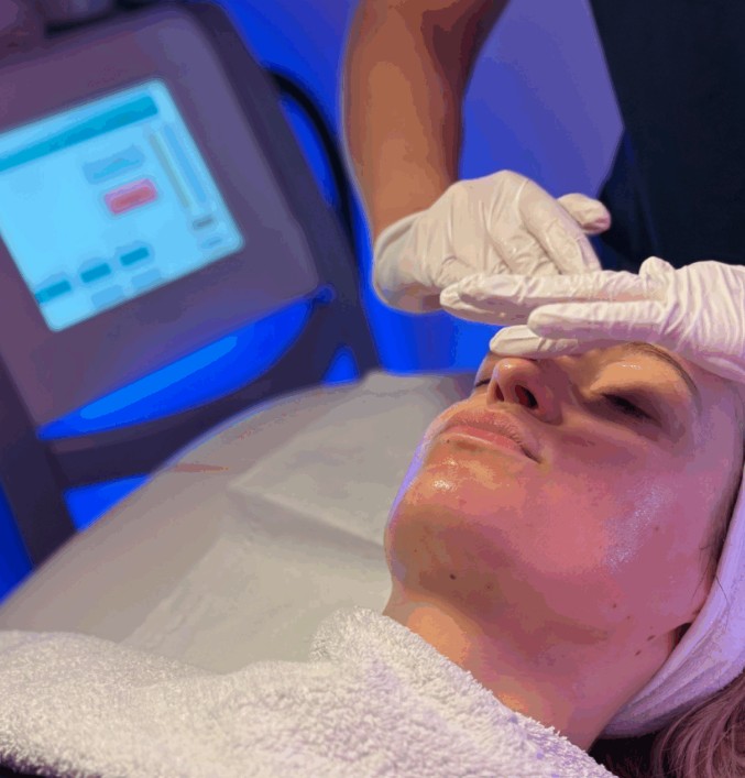 Laser facials at Sparx Skin Clinic in Winchester