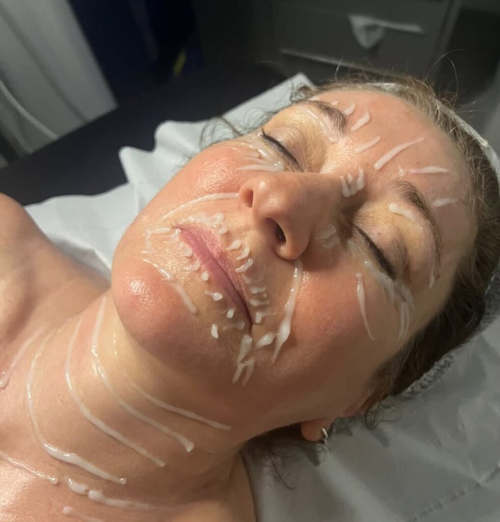 Filler Code Facial Winchester at Sparx Beauty Salon